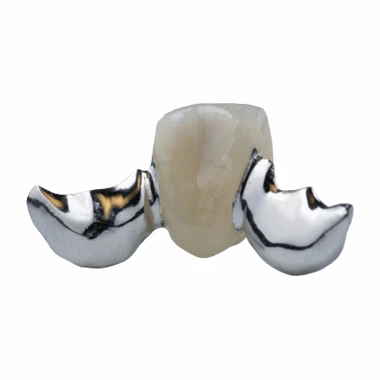 Single Metal Wing PFM Maryland Bridge