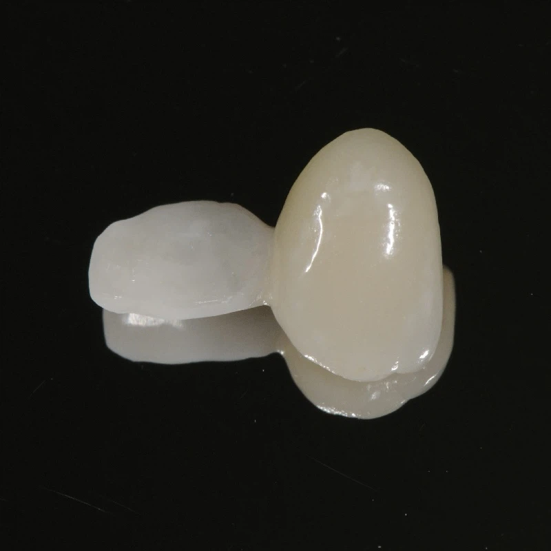 Single Zirconium Wing PFZ Maryland Bridge