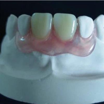 Qual è il costo di manutenzione delle protesi dentali valplast?